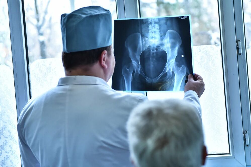O doutor mira unha imaxe dunha articulación da cadeira con artrose